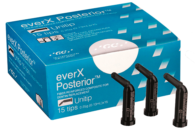 everX Posterior Unitips