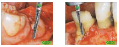 Mustermappe CAD/CAM Sirona